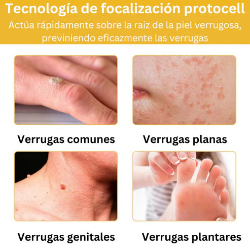 Tag Recede™: Spray Removedor de Verrugas